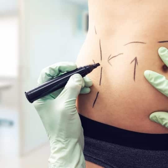 Body Contouring at Advanced Health Wellness Center