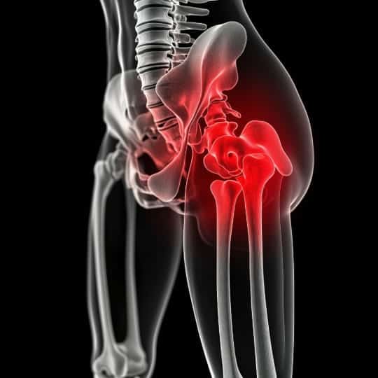 Sciatica and Leg Pain Graphic
