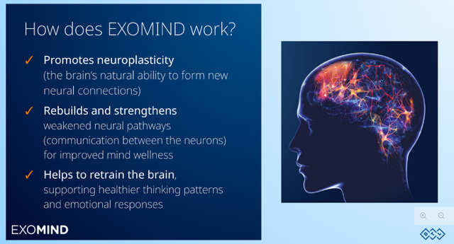 Exomind Treatment Img ScaleWidthWzIwNDhd